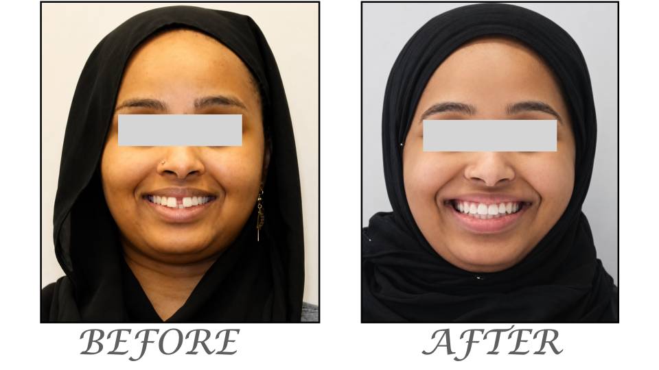 Patient case study