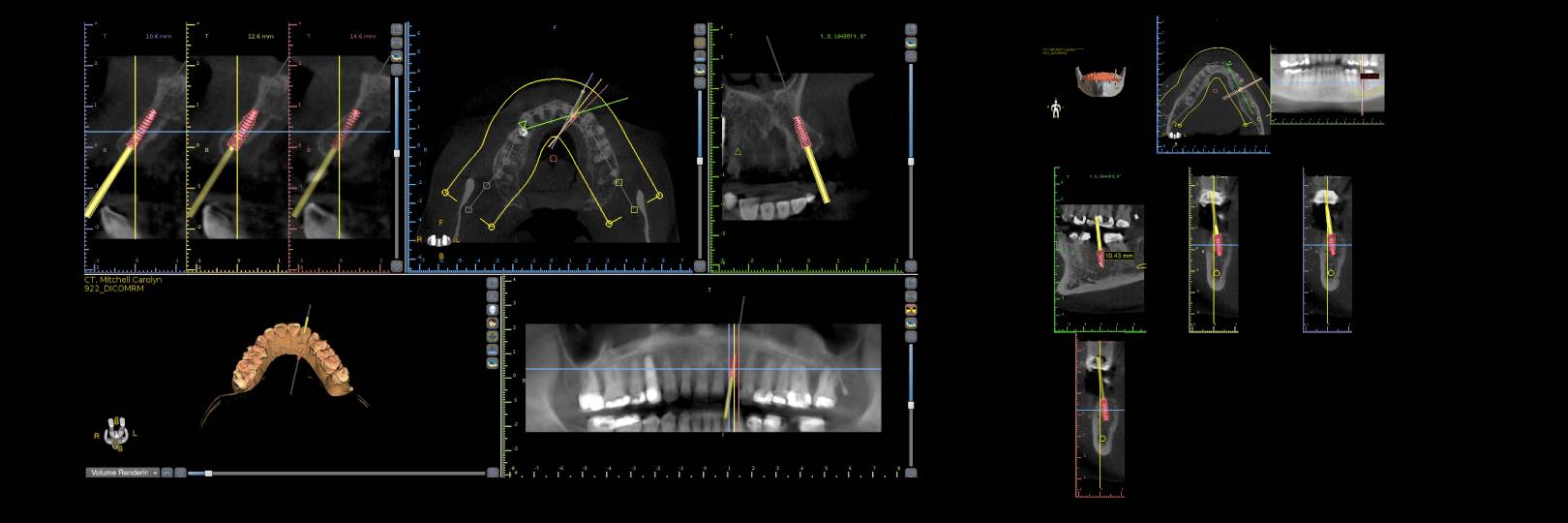 Patient case study