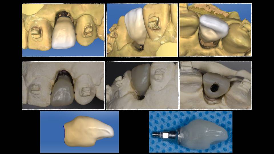 Patient case study