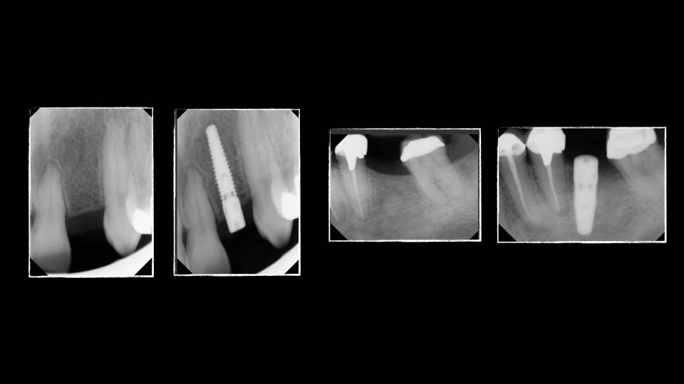 Patient case study