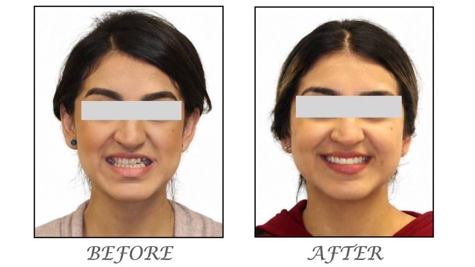 Patient case study