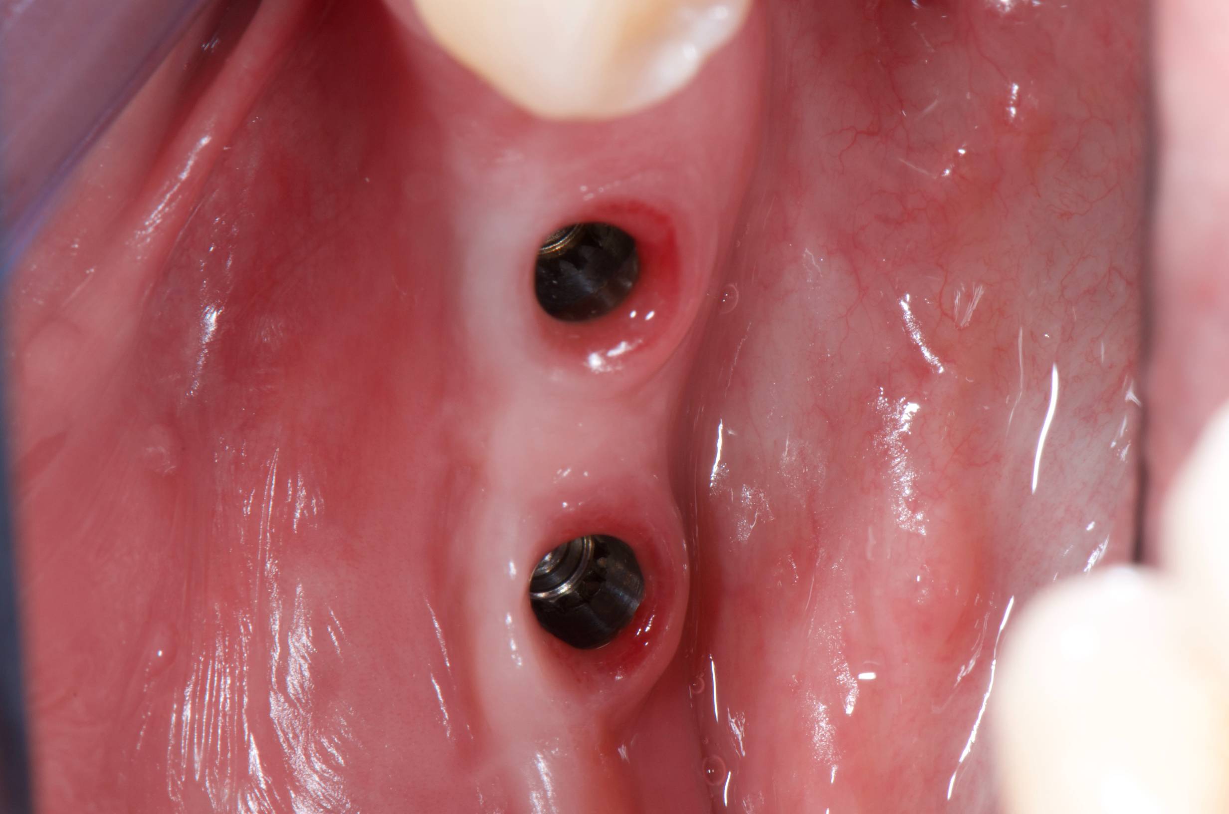 Patient case study