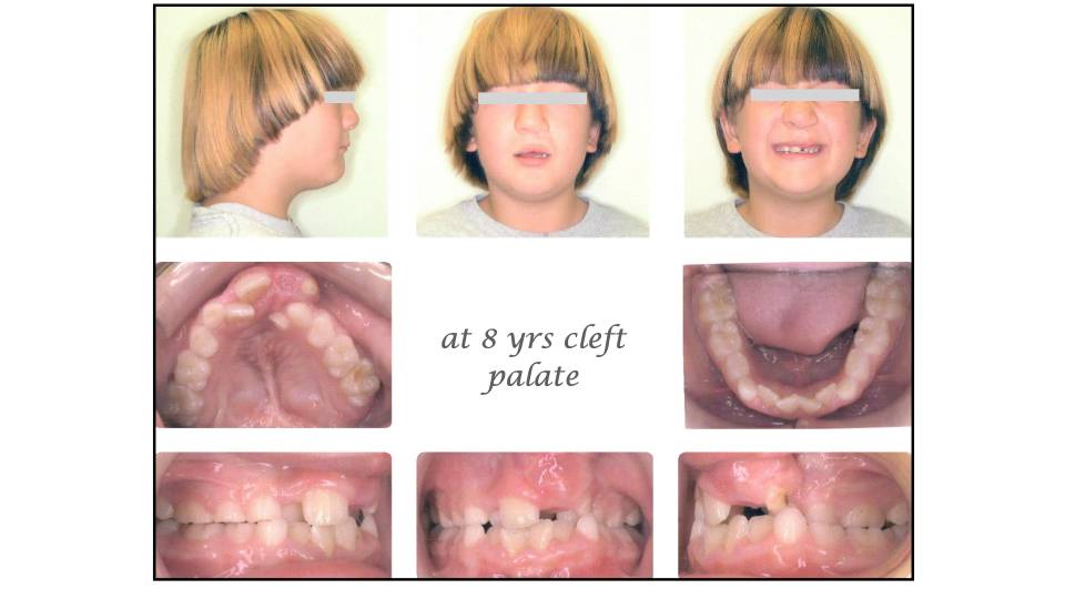 Patient case study