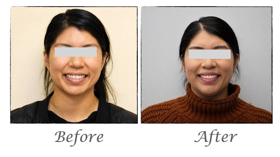 Patient case study