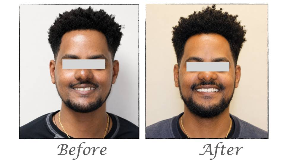 Patient case study