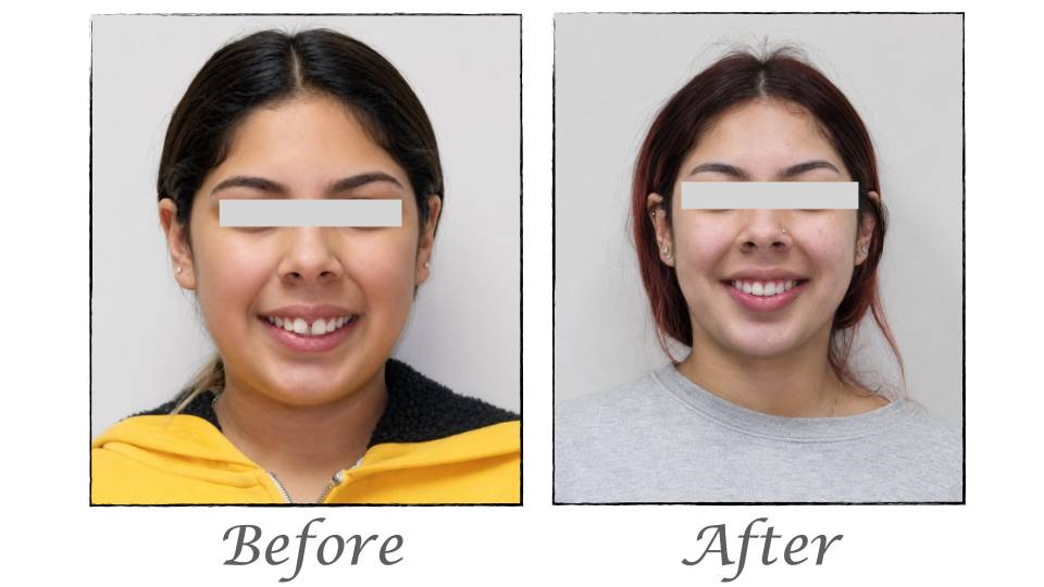 Patient case study