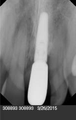 Patient case study
