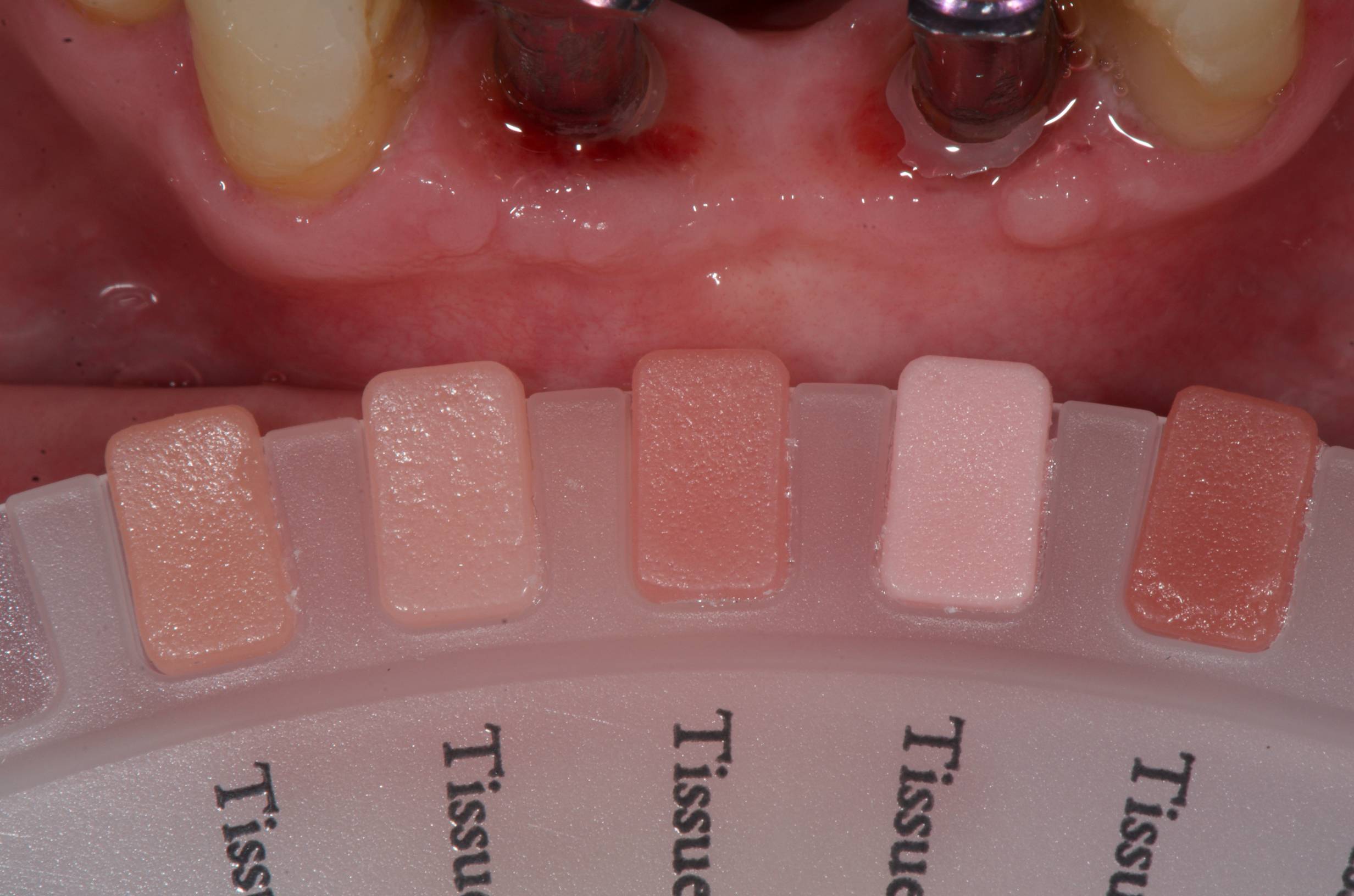 Patient case study