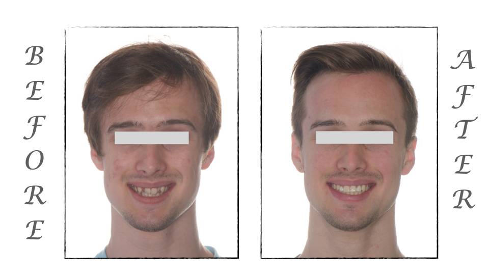 Patient case study
